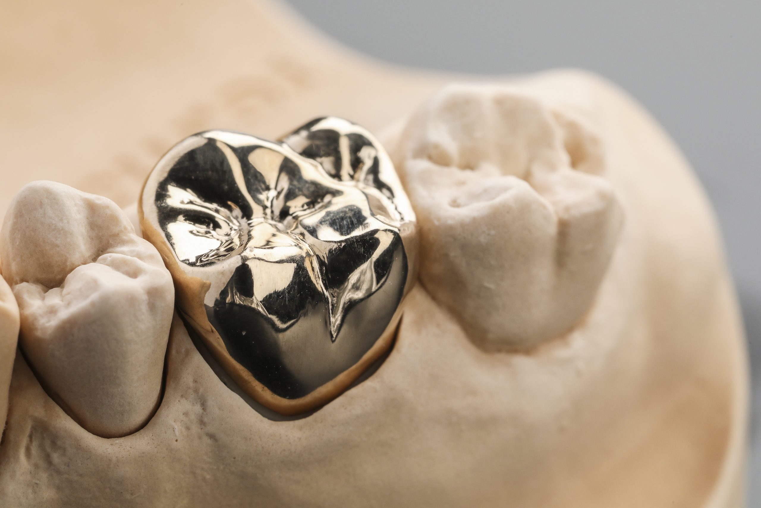 Gold and Ceramics Dental Laboratory © Salty Dingo 2018