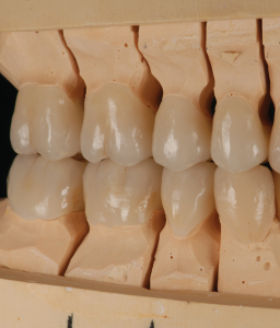 Ceramics_product-04